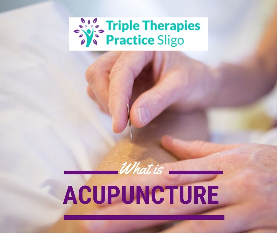 What is Acupuncture?   